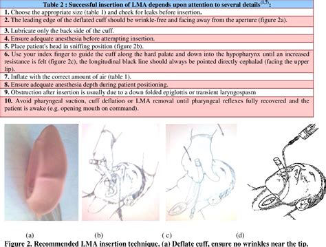 Laryngeal Mask Airway Sizes