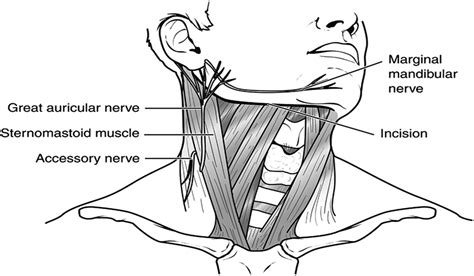 C2–C3 Anterior Cervical Fusion: Technical Report : Clinical Spine Surgery