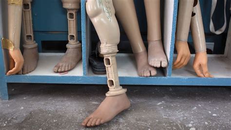 The geniuses who invented prosthetic limbs - BBC Future
