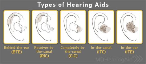 Hearing Aid Buyer’s Guide: Types of Hearing Aids