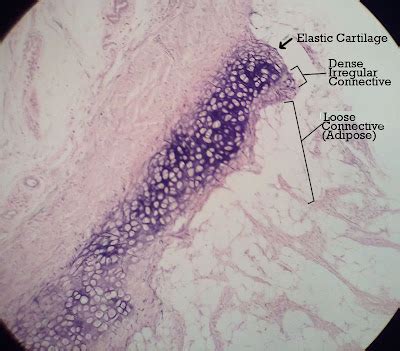 Duda's Epic Quest To Epicness: Epiglottis Histology