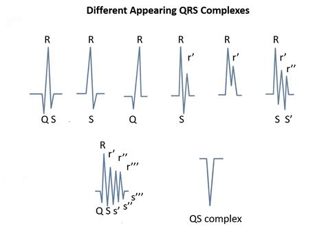 What is an rSR Prime (rSR')? - Executive Electrocardiogram Education