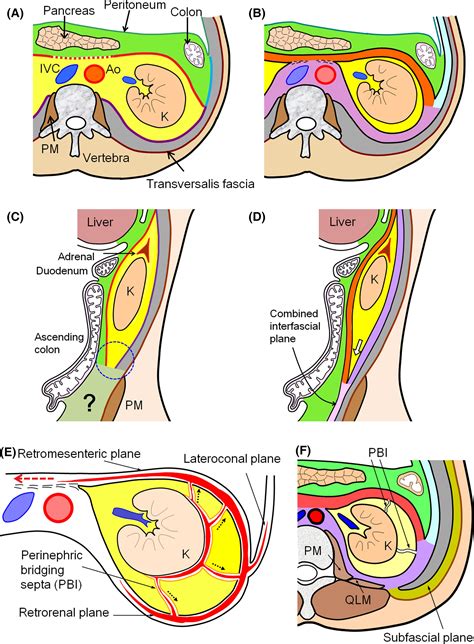 The retroperitoneal interfascial planes: current overview and future perspectives - Ishikawa ...