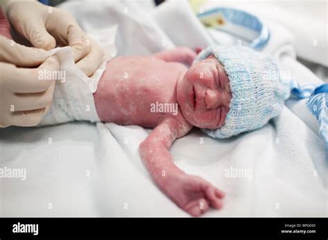 Vernix hi-res stock photography and images - Alamy