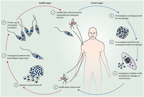 Leishmaniasis - The Lancet