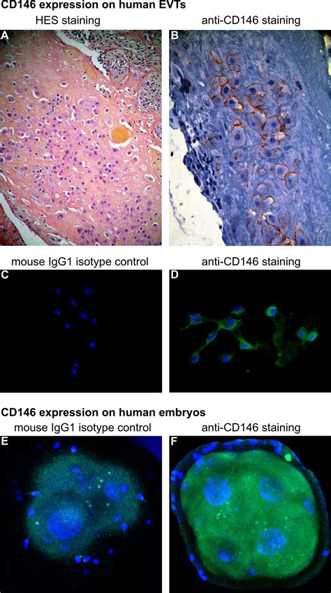 Frontiers | The Role of the Adhesion Receptor CD146 and Its Soluble Form in Human Embryo ...