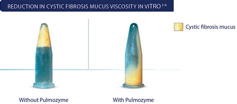 Pulmozyme® Cystic Fibrosis