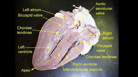 HEART DISSECTION PHOTO GALLERY - SCIENTIST CINDY