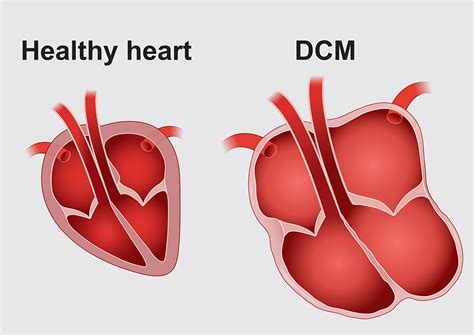 What Are The Signs Of Dcm In Dogs