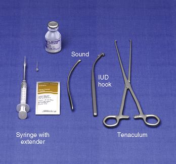 Intrauterine Device (IUD) Removal | Basicmedical Key