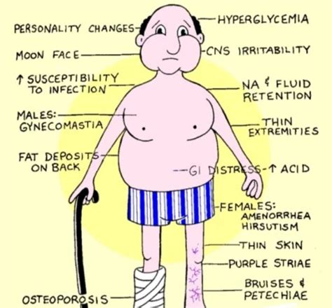 Cushing's Syndrome Symptoms