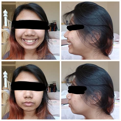 [Advice] I don't really like how my side profile look and I'm ...