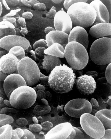 White blood cells - wikidoc