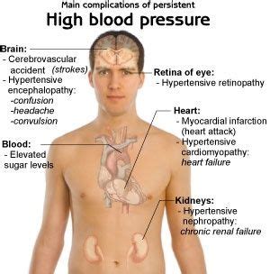 Blood Pressure Check more at http://www.healthyandsmooth.com/blood-pressure-formula/blood ...