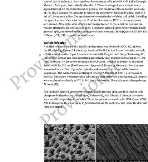 Scanning electron microscope images showing Enterococcus faecalis... | Download Scientific Diagram