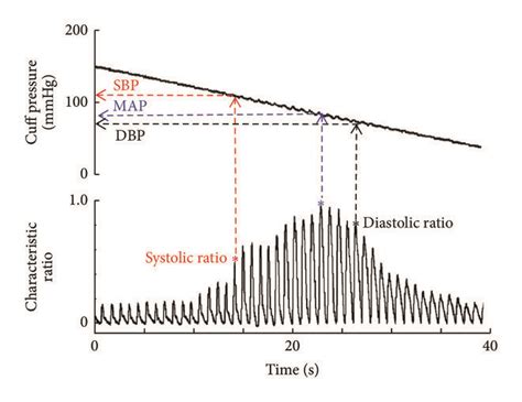 Recorded cuff pressure (top) and extracted oscillometric pulse waveform... | Download Scientific ...