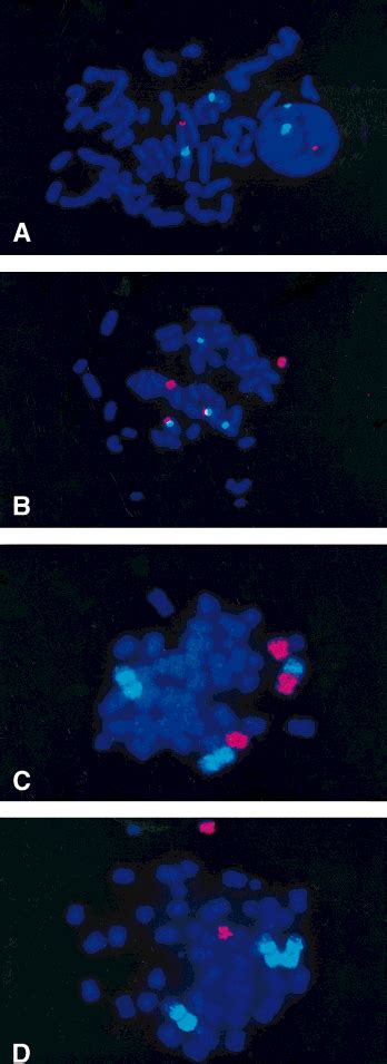 Structural aberrations of chromosome 1 demonstrated by double-target ...