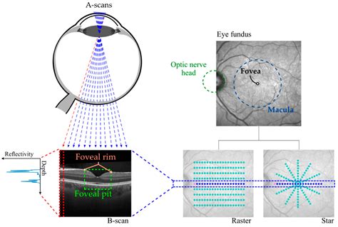 Entropy | Free Full-Text | Foveal Pit Morphology Characterization: A Quantitative Analysis of ...