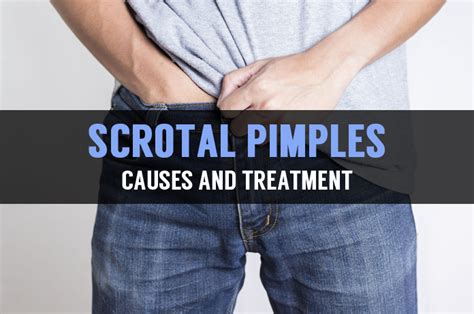 Causes and Treatment for Pimple on Scrotum or Testicles