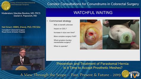 Prevention and Treatment of Parastomal Hernia: Is it Time to Accept ...