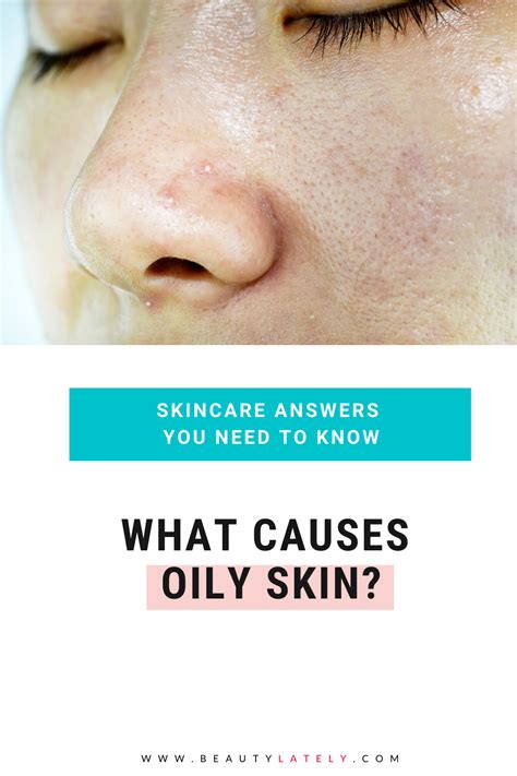 What Causes Oily Skin? | Oily skin, Skin facts, Cleansing oily skin