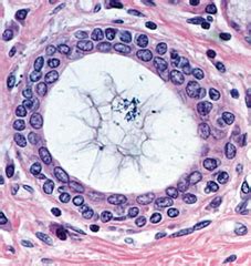 STRATIFIED CUBOIDAL EPITHELIUM. | Anatomy and Physiology- Histology Slides | Pinterest