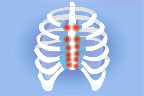 Sudden chest pain in women - lasopacars