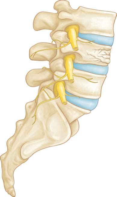 Fractures of the Thoracic and Lumbar Spine - OrthoInfo - AAOS