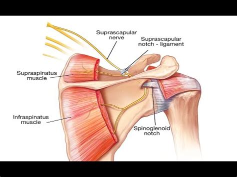 Suprascapular Ligament