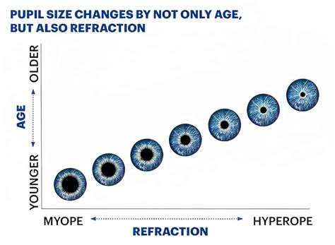 Pupil Size Chart Normal