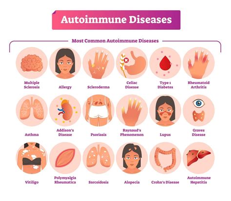 Exploring Autoimmune Diseases: Causes, Symptoms, and Treatment Options - Vikvr