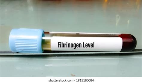 189 Fibrinogen Stock Photos, Images & Photography | Shutterstock