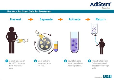 Stem Cell Therapy for Arthritus – Arthritus Stem Cell Cures