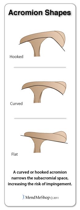 FST - Функционально-силовой тренинг: Shoulder Impingement Syndrome