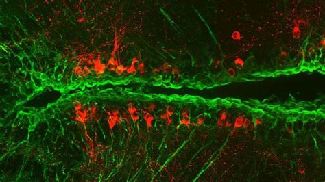 Zebrafish Show the Way to Brain Cell Regeneration in Parkinson's ...