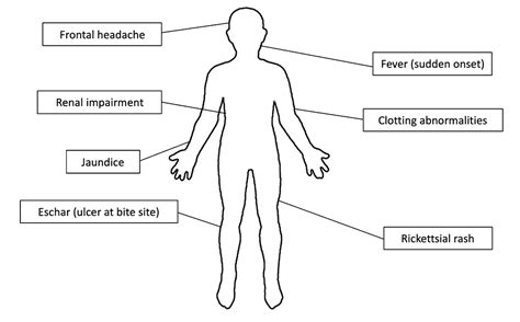 Scrub Typhus Rash