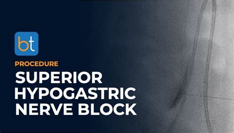 Superior Hypogastric Plexus Block Procedure | BackTable VI