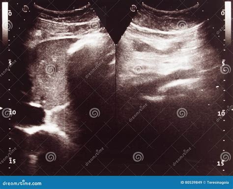 Diagnostic Sonography Of Abdomen Stock Image | CartoonDealer.com #80539699