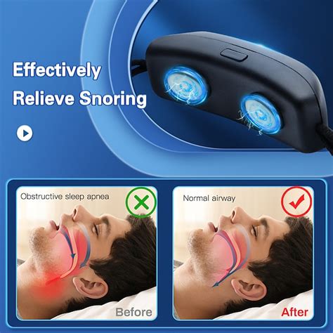 Smart Anti Snoring Device EMS Pulse Stop Snore Portable Comfortable Sleep Well Stop Snore Health ...