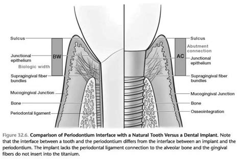 Anatomy of the Dental Implant - Foundations of Periodontics: Surgical anatomy dental implants