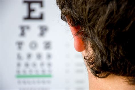 Myopia: Symptoms, Causes & Treatment | Kraff Eye Institute