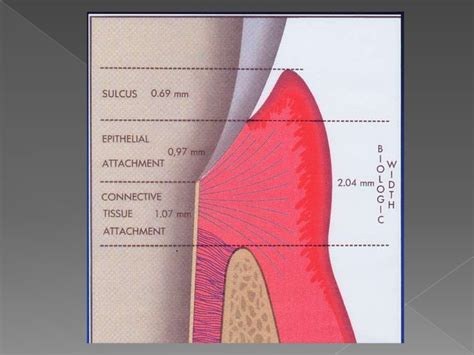 Biologic width - Importance in Periodontal and Restorative Dentistry