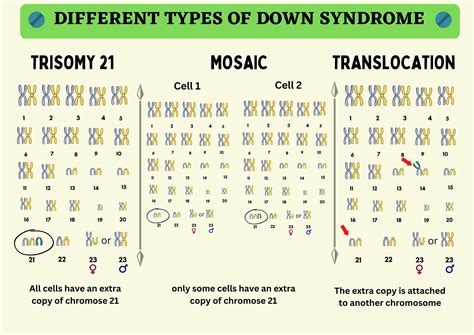 Understanding Down Syndrome: Causes, Types, and Management