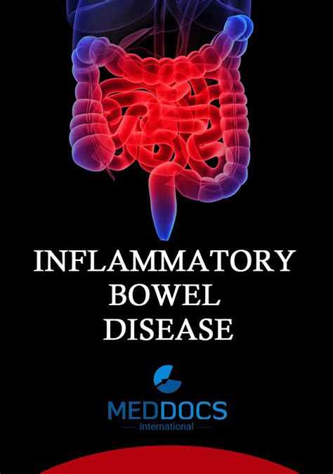 Inflammatory Bowel Disease