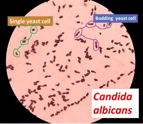 Yeast cells on gram stain gram positive: Introduction, Procedure and Result