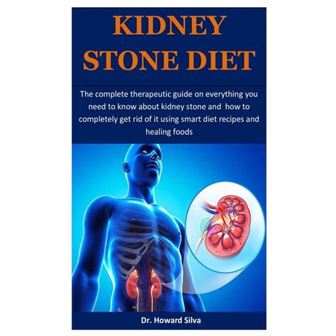 Kidney Stone Diet : The complete therapeutic guide on everything you need to know about kidney ...