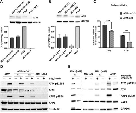 Gene correction restores full-length ATM kinase expression and ...