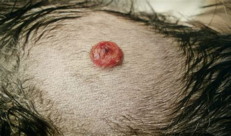 5 Most Dangerous Cancerous Tumors in Dogs – Top Dog Tips
