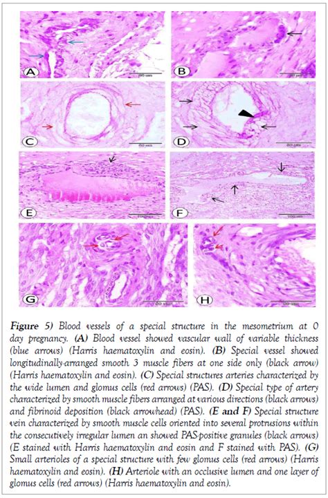 A histological, histochemical and ultrastructural characterization of uterine vessels at early ...