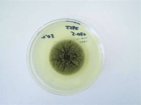 Pithomyces - Mold, Species, Infection and Treatment